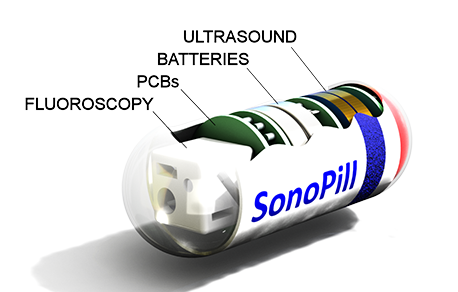 Design of Sonopill showing integrated sensing modes