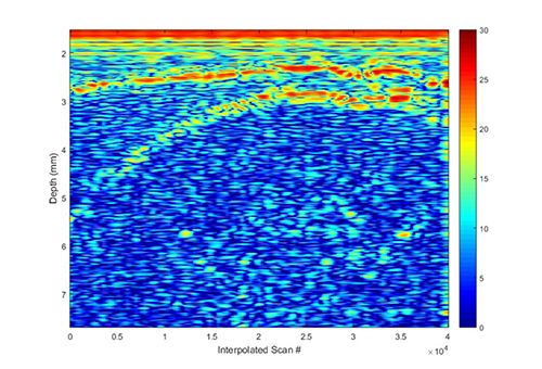 Ultrasound image from a prototype device