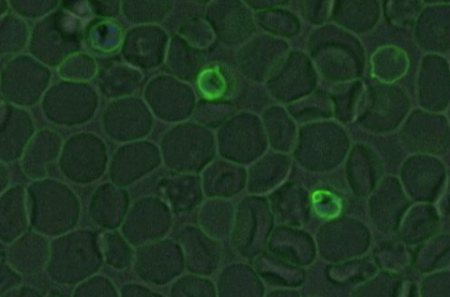 image of malaria cells