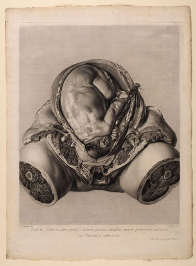 Gravid Uterus plate VI, George Powle, fl.1770.