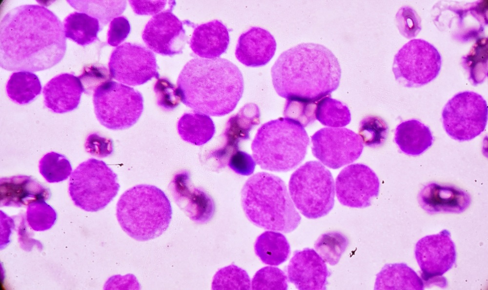 AML-Leukaemia450