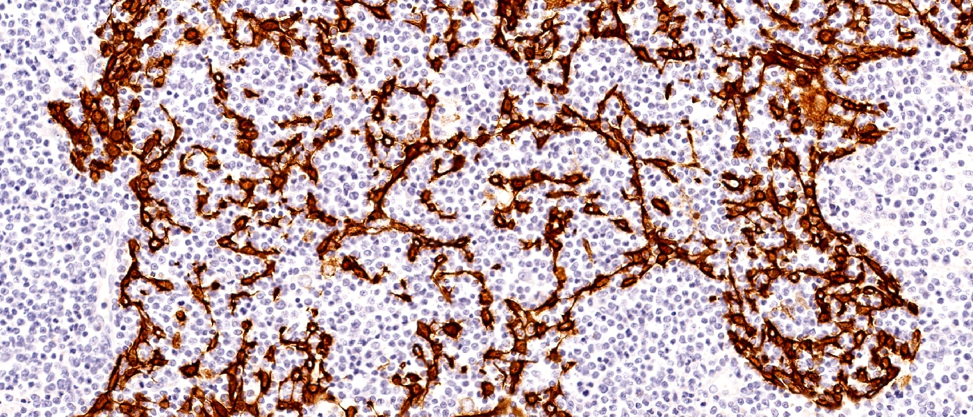 Canine Thymus, IHC Staining with Cytokeratin