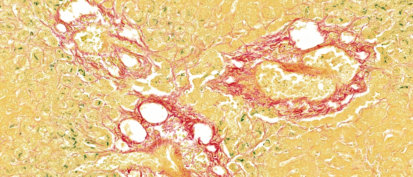 Canine Liver, Fouchet Staining