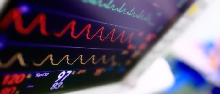Close up of a heart monitor screen