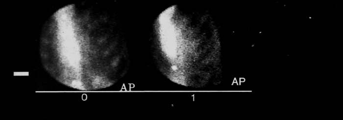 Technetium scans from 1970s