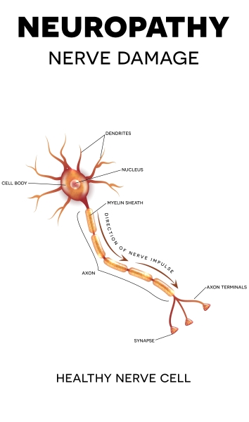 Healthy axion Neurology