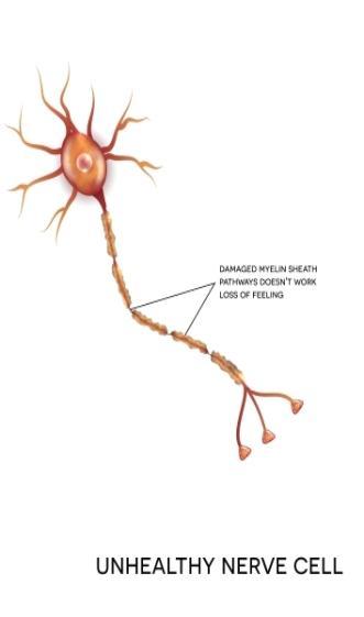 Diagram of an unhealthy axion 