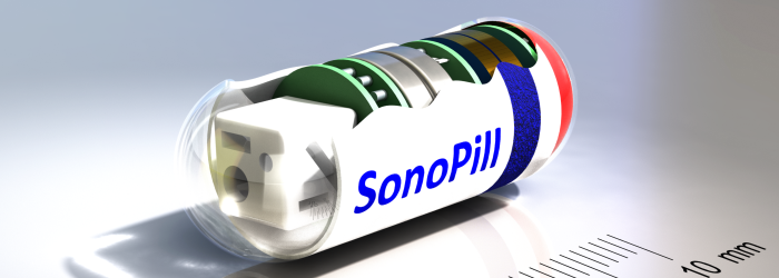 A 3D image of a Sonopill capsule cut away to show the internal components
