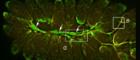 Toxoplasmosis 700x300