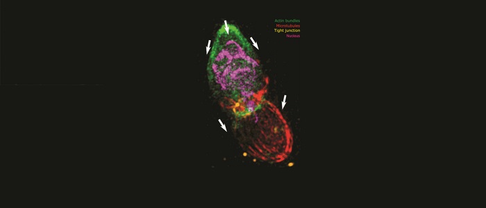 Image from the study's synopsis that proposes a push‐and‐pull mechanism whereby F‐actin machinery eases nuclear passage