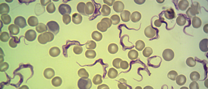 Trypanosoma brucei parasites in a blood smear stained with Giemsa (credit Keith Vickerman)