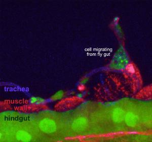 A RAS-APC-P53-PTEN cell leaving the hindgut