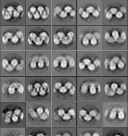 2D class averages from cryo-EM that show different lengths and curvatures of spirosomes