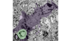 A microscopic view of a phagocyte cell