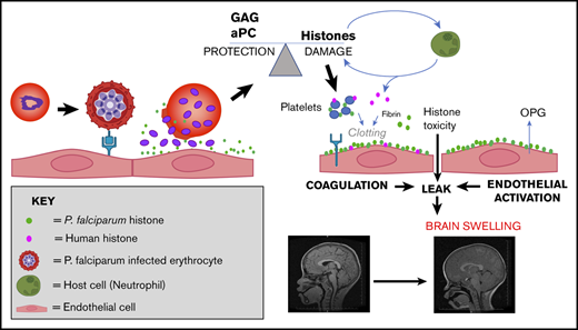 Cerebral malaria abstract image showing diagrams and charts