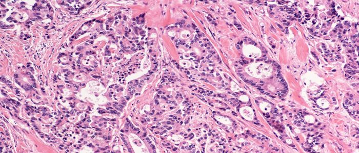 Image of a histology section