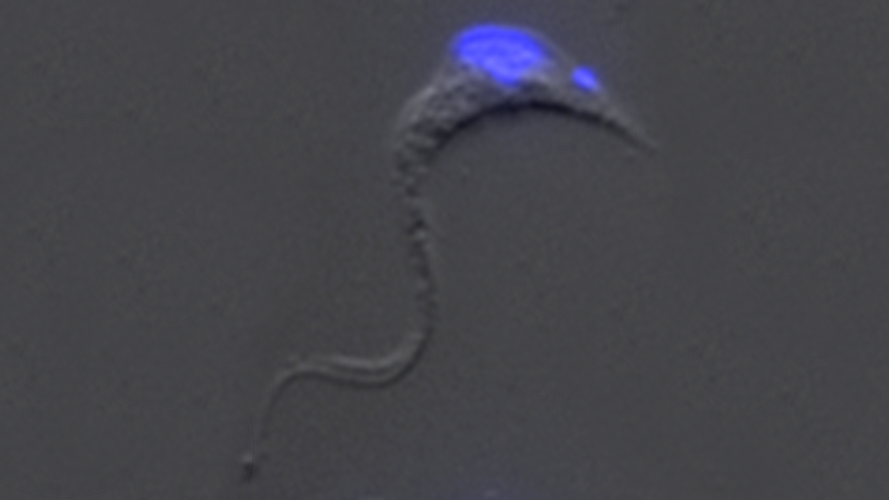 Epifluorescence Microscopy image example i