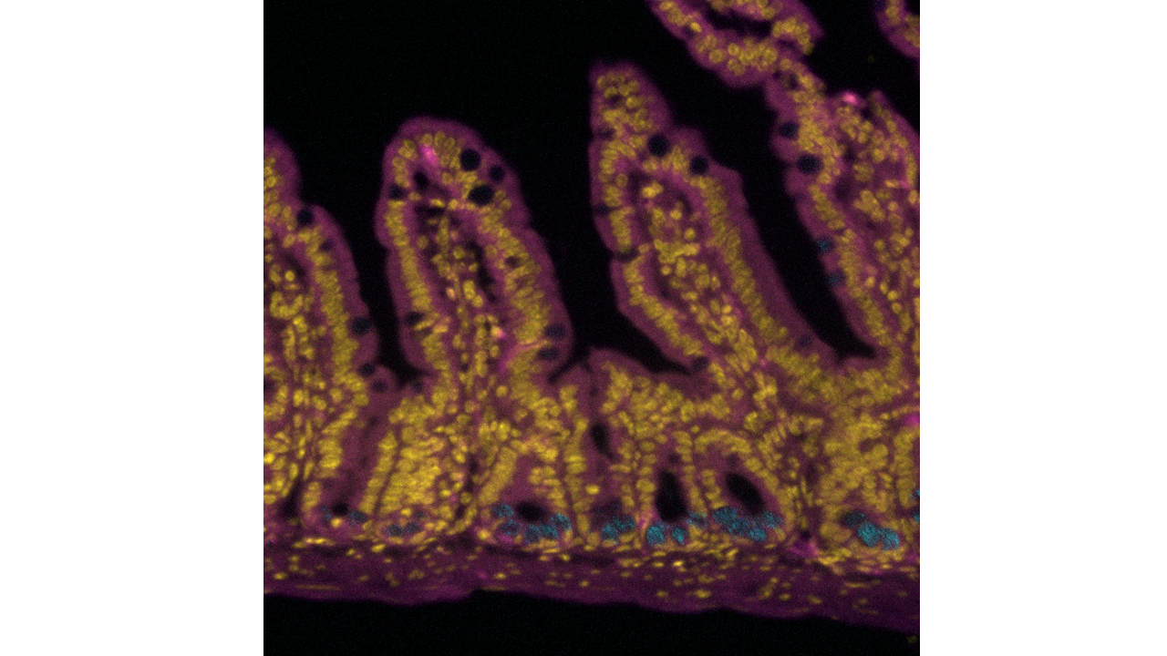 Epifluorescence Microscopy image ii
