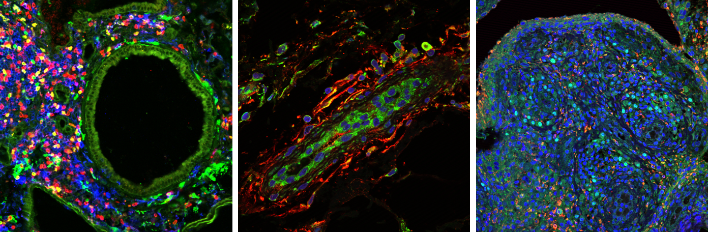 Three Confocal Imaging examples, by Joshua Gray and Leandro Lemgruber