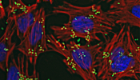 A figure showing E. coli O157 bacteria (green) infecting human cells (red)