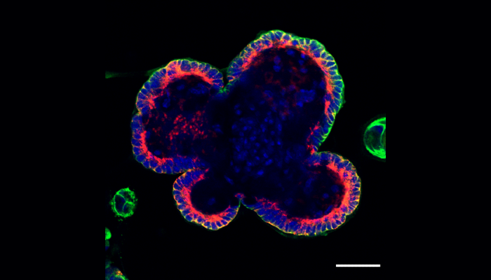 Stimulation of IEC organoids with the inflammatory cytokine IFN-gamma causes a rapid increase in expression of MHC II molecules (red), which predominantly localise within intracellular vesicles and at the basal surface of the IEC - the normal interface with immune cells. Green staining indicates expression of an IEC marker (E-cadherin) and blue staining shows the cell nuclei (DAPI)