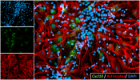 Astrocytes expressing Cxcl10 (an antiviral interferon stimulated gene and chemokine)