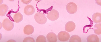 Trypanosomes in blood