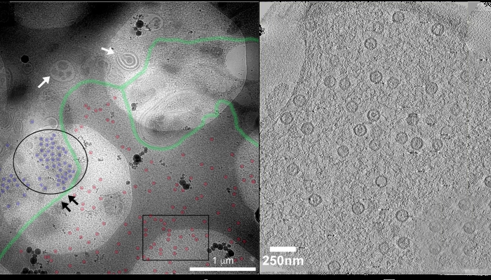 (l) EM imaging of refrozen cell sections using For easy visualisation, segmentation of the image in (a) using Photoshop is shown annotating probable edges of the nuclear membrane (green), nuclear capsids (red) and cytoplasmic capsids (blue)(r) Z-slices through tomograms of cytoplasmic and nuclear capsids of areas denoted in