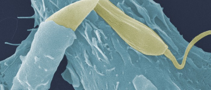 Micrograph of leishmania parasite.