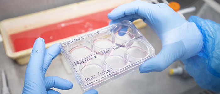 A picture of someone holding a 6 well plate with SARS-CoV-2 cells being treated with different drugs. 