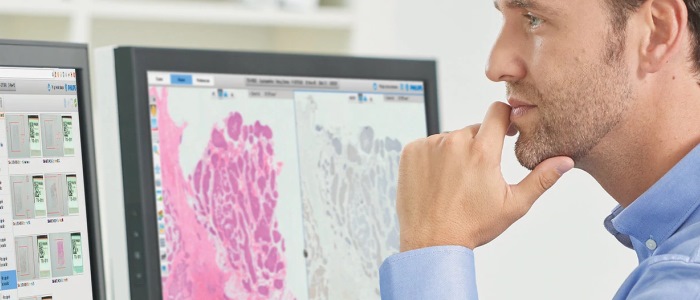 Male looking at histology section on computer screen