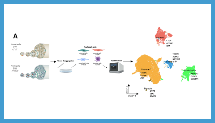 Normal (n=4, human hamstring tendon) and diseased (tendinopathy, n=5, human supraspinatus tendon) human tendon were processed for single cell analysis using Chromium 10x 3′DEG chemistry. Infographic shows number of donors and cells sequenced.