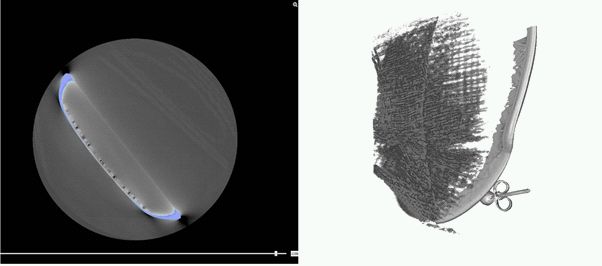Micro CT images of a modern mixed materials of gold, silver and textiles. Left: 2D slice where the sliver shows most clearly in blue, the textiles are seen faintly top right. Right: 3D volume rendering (Images © S.Harris, A. Douglas).