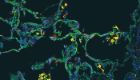 The cover image from the July 2021 edition of JCI Insight shows SPP1+ macrophages in alveoli in a COVID-19 postmortem lung, with immunostaining for SPP1 (green) and the macrophage marker CD68 (red). Nuclei were stained with DAPI (blue).