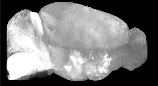 An image of a mouse brain created using the RAPID imaging system