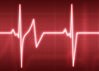 Heart monitor 140