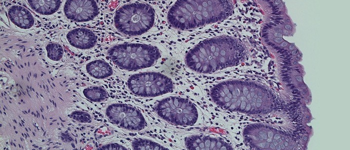 Microscope slide showing healthy human colon