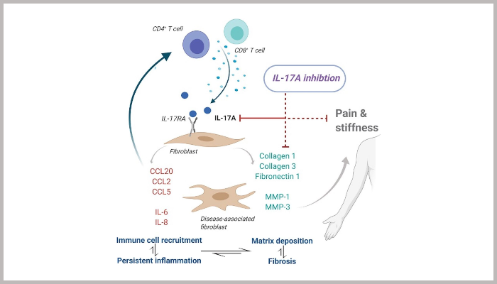  Schematic diagram illustrating possible IL-17A–driven pathogenesis in frozen shoulder. The presence of IL-17A–secreting T cells results in the fibrosis, inflammation, and further recruitment of pathogenic T cells, resulting in disease chronicity, which can be attenuated by use of an anti–IL-17A monoclonal antibody.