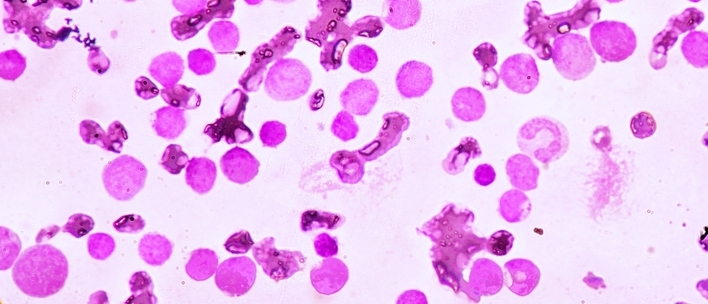 Chronic myeloid leukaemia cells