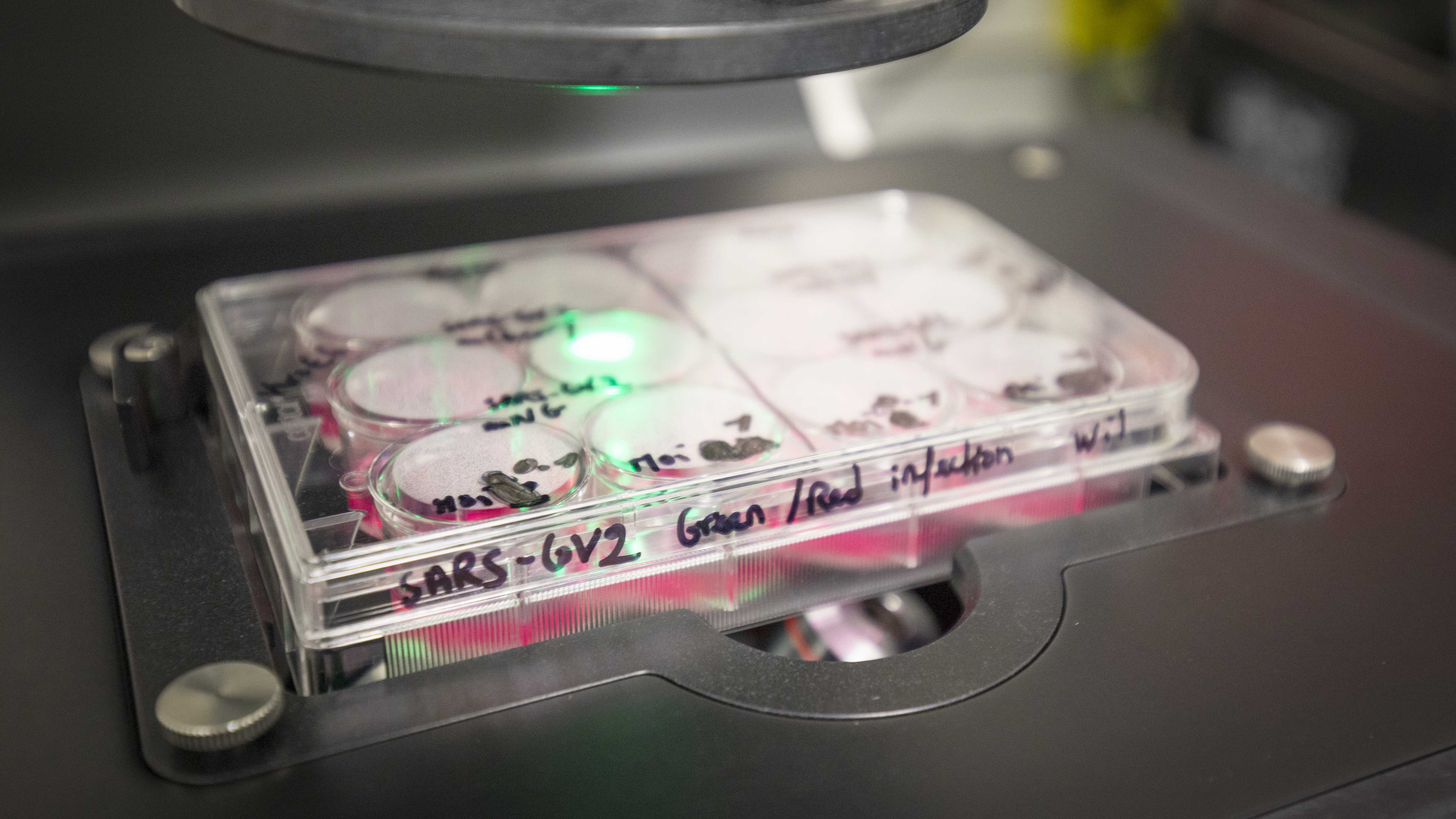 Image of a 24 well plate containing cells infected with SARS-CoV-2 under a widefield microscope