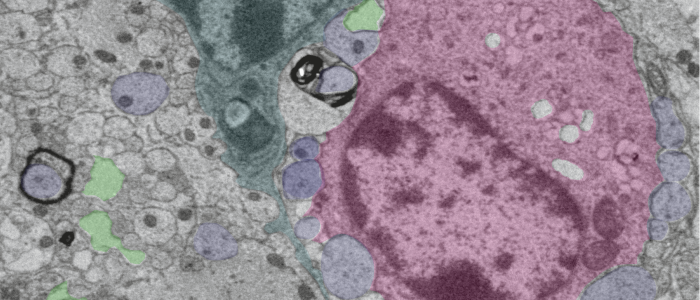 Neuroimmunology tile_ An oligodendrocyte, axons and an activated microglial cell in a demyelinating brain