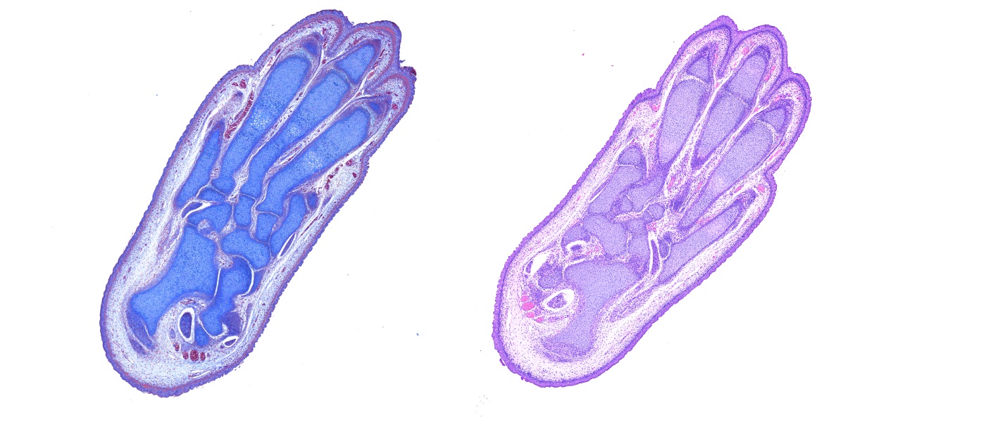 Paw from mouse embryo, left Masson’s Trichrome stain, right H&E stain