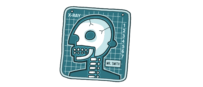 Cartoon X-ray of a person's head. 