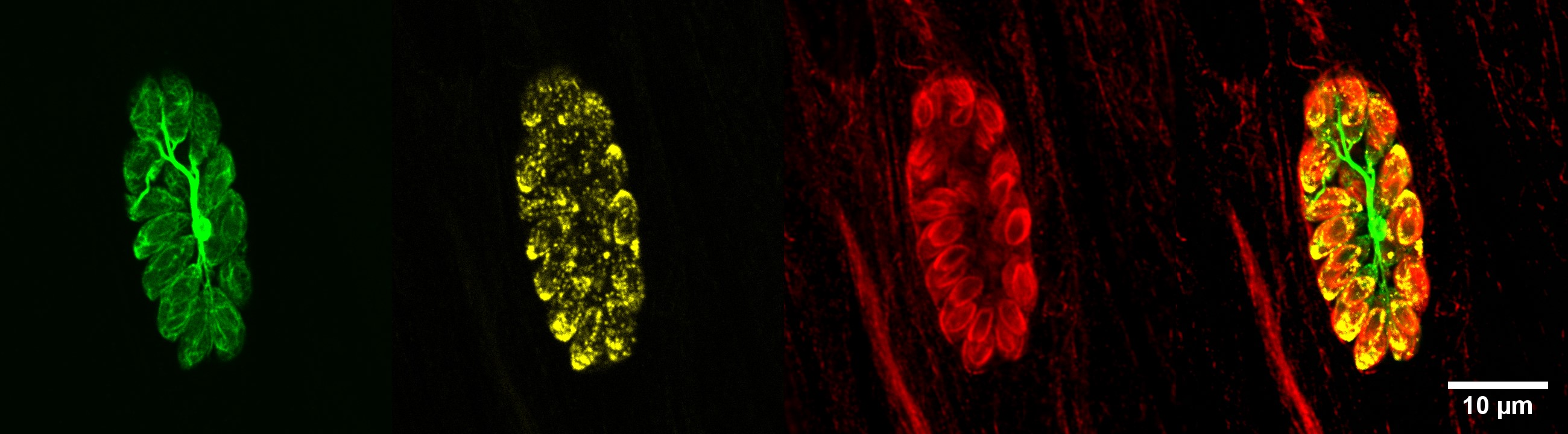 The image shows intracellular parasites that are connected by the intravacuolar network. The disassembly of this network is one of the first crucial steps for the parasite to exit from the host cell.