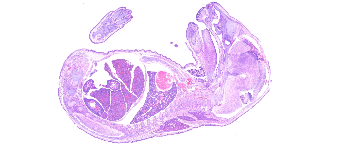 Mouse embryo H&E stain