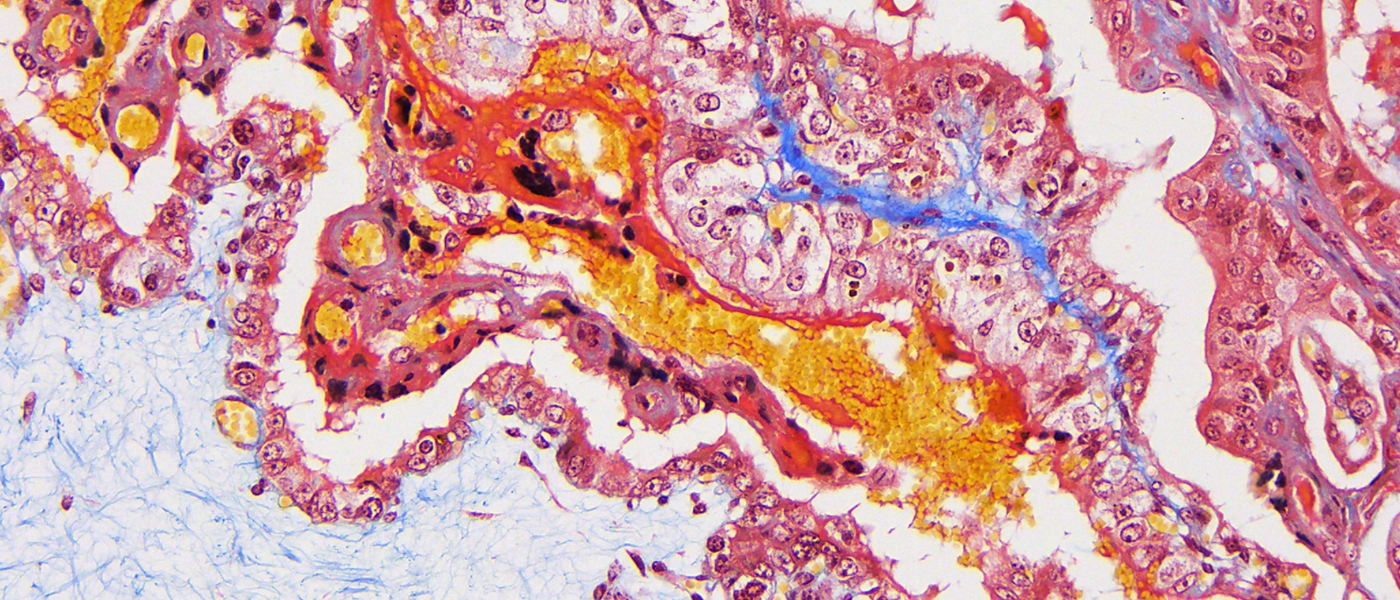 Ovine Placenta stained with Martius, Scarlet and Blue (MSB)
