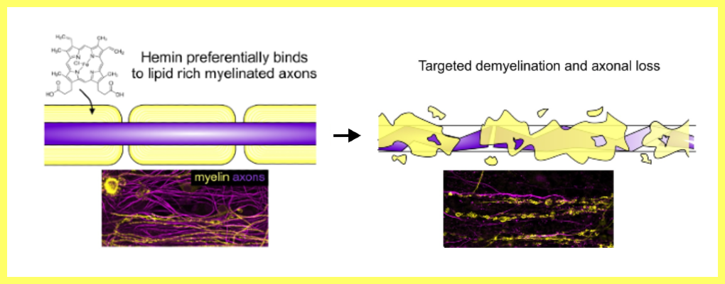 Graphical abstract showing Myelinated axons are the primary target of hemin-mediated oxidative damage in a model of the central nervous system