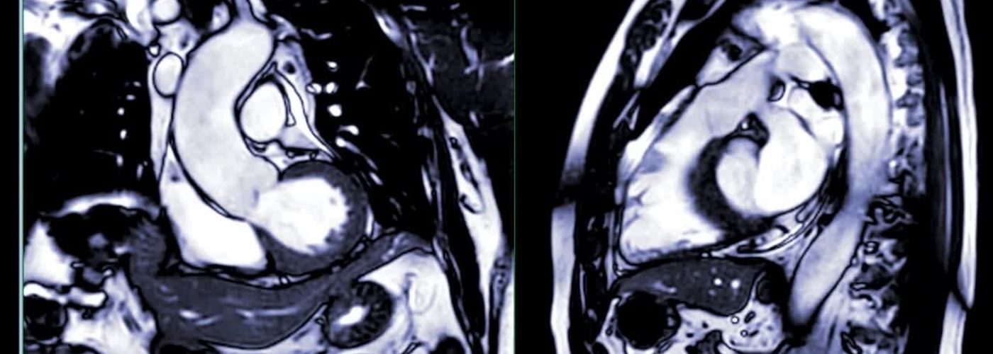 Image of human heart inside the body