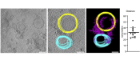 Segemented slices through cryo-electron tomogram showing exocyst-mediated liposome tethering