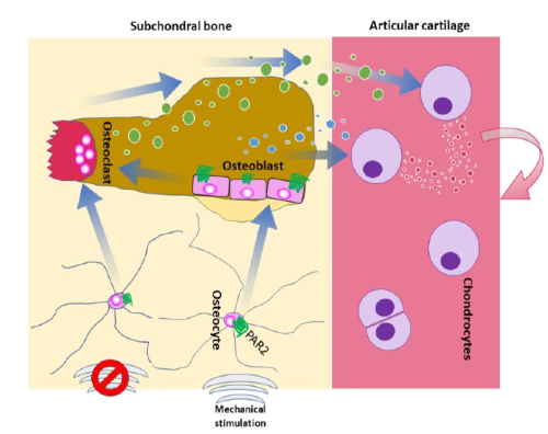 An illustration of the research, showing subchondral bone and articular cartilage